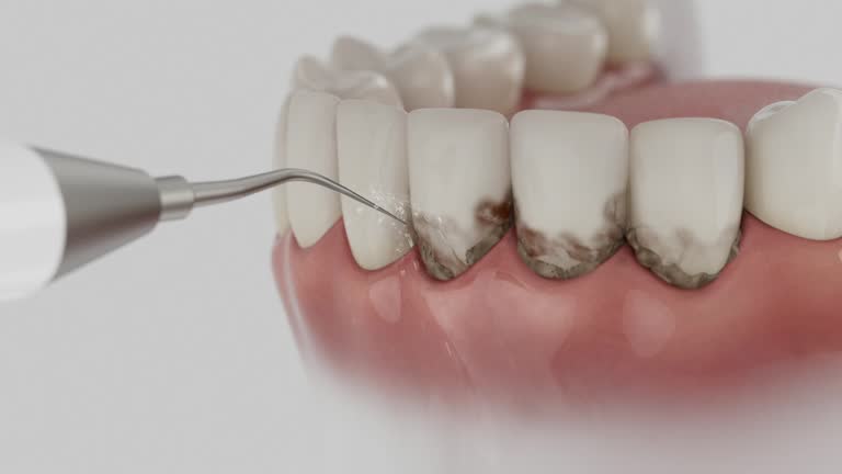 Trusted Tooth Extraction service in Centreville, MD - Dentist Open Now